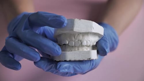 Modelo de yeso de los dientes antes de instalar el sistema de soporte