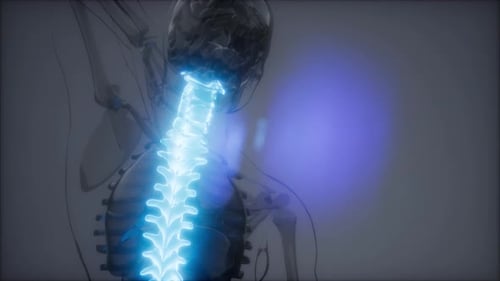 Backache in Back Bones