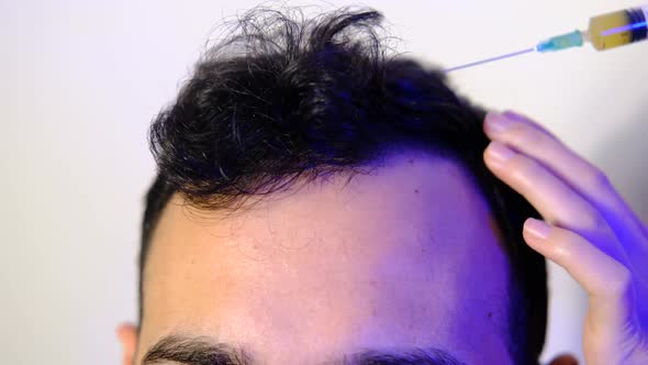 Man Receiving Hairline Injections, People Stock Footage ft. hair ...