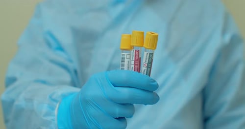 Medical Worker Holding COVID-19 Test Tubes