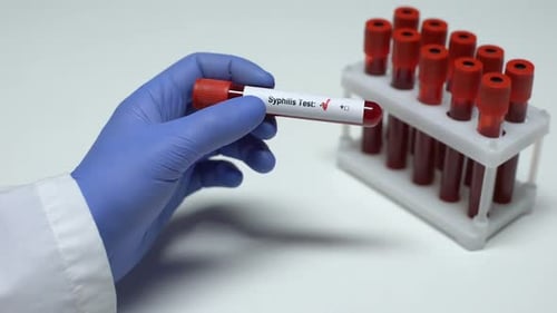 Blood Sample Indicates Positive Syphilis Test Result