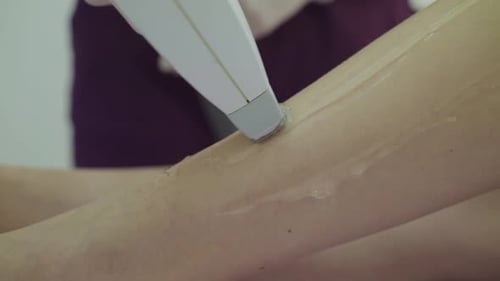 Close Laser Hair Removal on Female Slim Legs Lying on Couch in Treatment Room