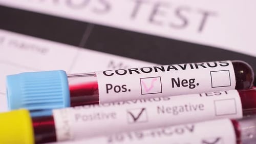 Close Up of Coronavirus Blood Sample Test Tubes