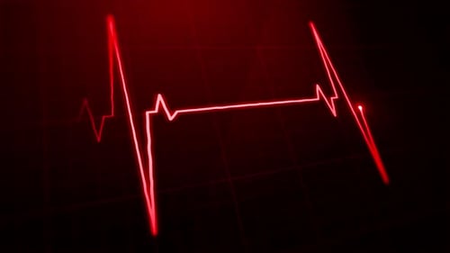 EKG-Pulse-Bildschirm