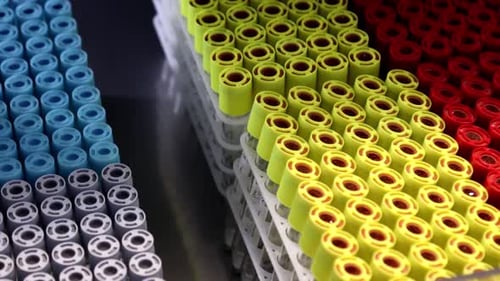 Rows of test tubes in laboratory setting