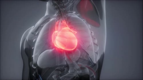 Radiologische Untersuchung des menschlichen Herzens
