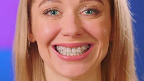 Woman Smiling, Showing off Teeth Braces in Close Up