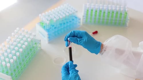 Close Up View of a Doctor in a White Protective Gloves Looking on a Blood Sample in a Test Tube.