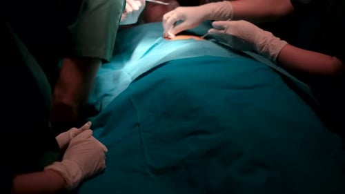 Medical Team Performing a Surgery in Hospital