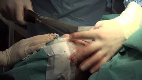 Medical Professional Performing Procedure on a Patient