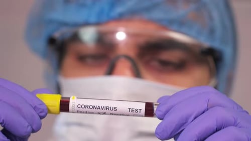 Close up of Medical Worker Holding Coronavirus Blood Test