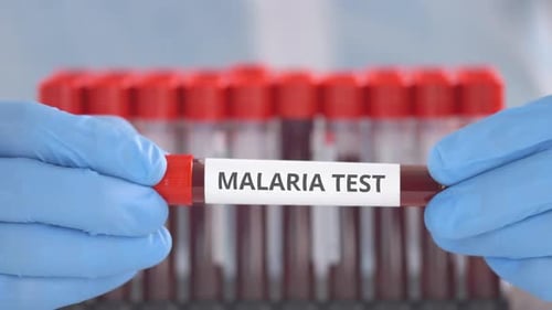Malaria Test Blood Sample in Test Tube