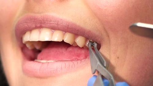 Boca de mujer y soporte.