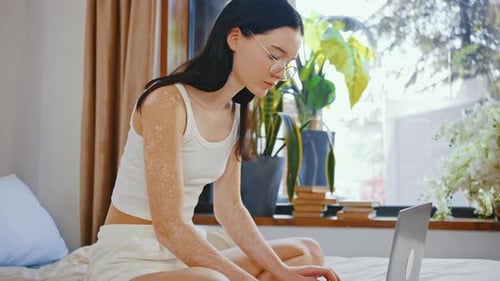 Junge Dame in Brille mit ungleichmäßiger Pigmentierung arbeitet am Laptop, sitzt zu Hause auf dem Bett, Zeitlupe