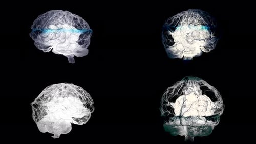 Four brains spinning with mri scanning