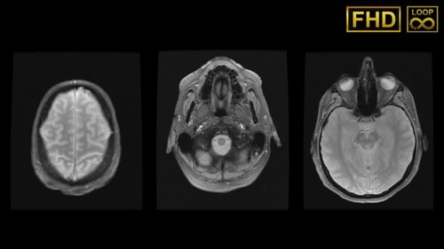 Human Brain MRI Scan Medical Loop