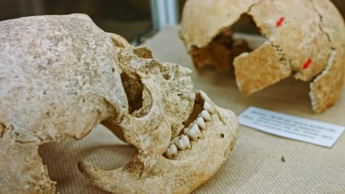 Human Skull in a Showcase