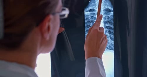 Woman Doctor Examines Spinal Column X-Ray Close Up