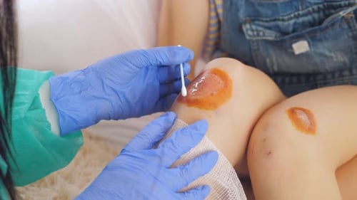 Closeup a Doctor in Medical Sterile Gloves Cotton Swab Treated with Antiseptic Bleeding Wound on the