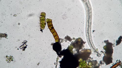 Nematode Worm Closeup Between Bacteria and Algae Looking for Food