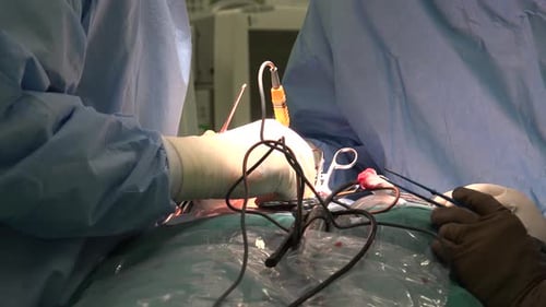 Surgeons Performing Operation in Operating Room