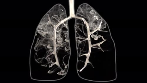 Lung Structure with Smoke