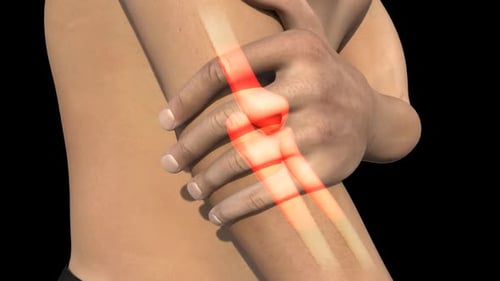 Animated Elbow Joint Pain and Bone Structure Highlight