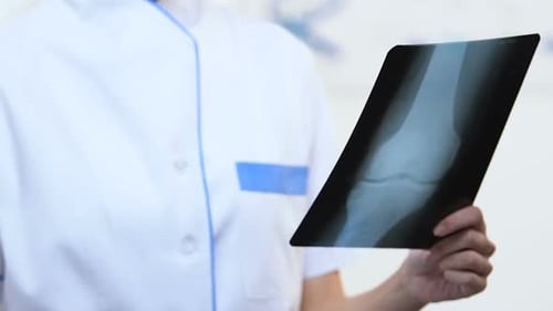 Female Traumatologist Comparing X-Ray With Broken and Healthy Bone, Recovery