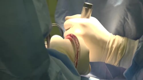 Surgical Operation in Hospital with Doctors and Tools