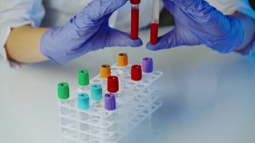 Blood Samples Analyzed in Medical Laboratory Setting