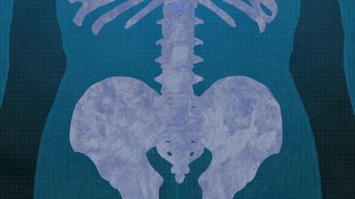 3D Medical Scan of Human Spine and Pelvis with Highlighted Pain