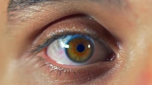 Extreme Close-up of a Person's Brown and Yellow Eye