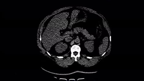 MRI Diagnostic Ultrasound View Examination Visualization Animation