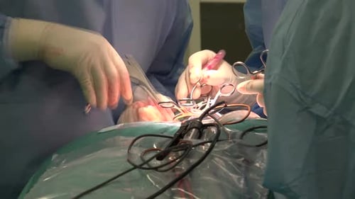 Surgeons Performing a Detailed Operation