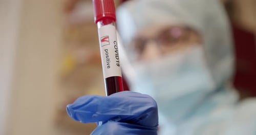 Scientist Holds Up COVID-19 Positive Blood Test