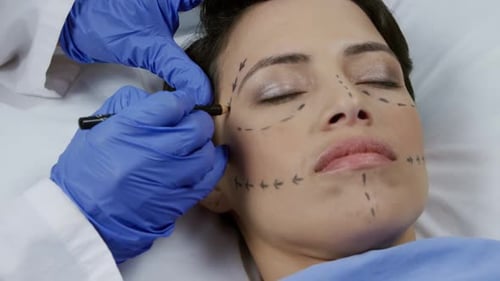 Doctor Marks Woman's Face for Cosmetic Surgery