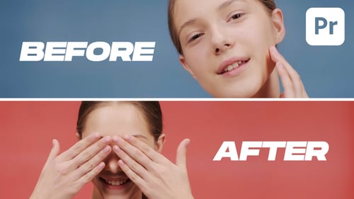 Dynamic Before & After