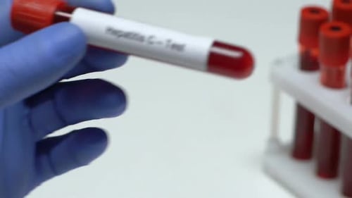 Hepatitis C-Test, Doctor Holding Blood Sample in Tube Close-Up, Health Check-Up