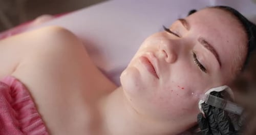 Cosmetologist Does Vitamin Injections to the Woman's Face Botox and Hyaluronic Acid Rejuvenating