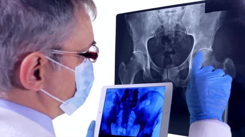 Doctor Examines Pelvic X-Rays on Screen and Tablet