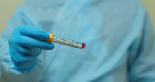 Positive Test Tube for Disease in Lab