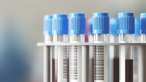 Rotating Blood Sample Tubes in Medical Laboratory Rack