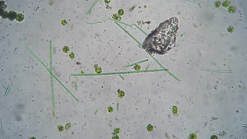 Long Green Unicellular Sticks and Round Bacillus are Moving Magnified Under Microscope