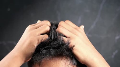 Man Scratching Itchy Scalp with Both Hands