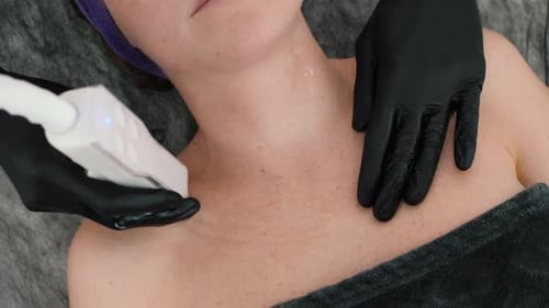 Laser Skin Treatment in Beauty Clinic