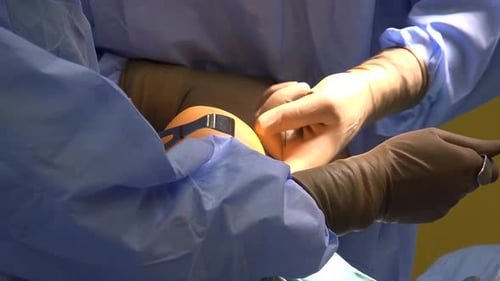 Surgeons Perform Knee Surgery in Operating Room