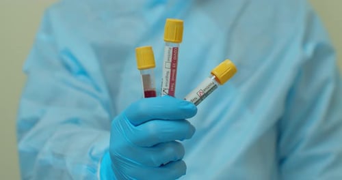 Medical Professional Holding COVID-19 Blood Test Results