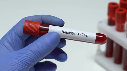 Hepatitis B-Test, Doctor Holding Blood Sample in Tube Close-Up, Health Check-Up