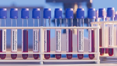 Animated Blood Test Tubes Checking Positive Negative Results