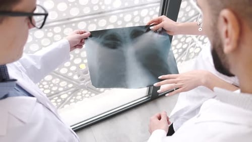 Doctors Reviewing Chest X-Ray Together in Hospital